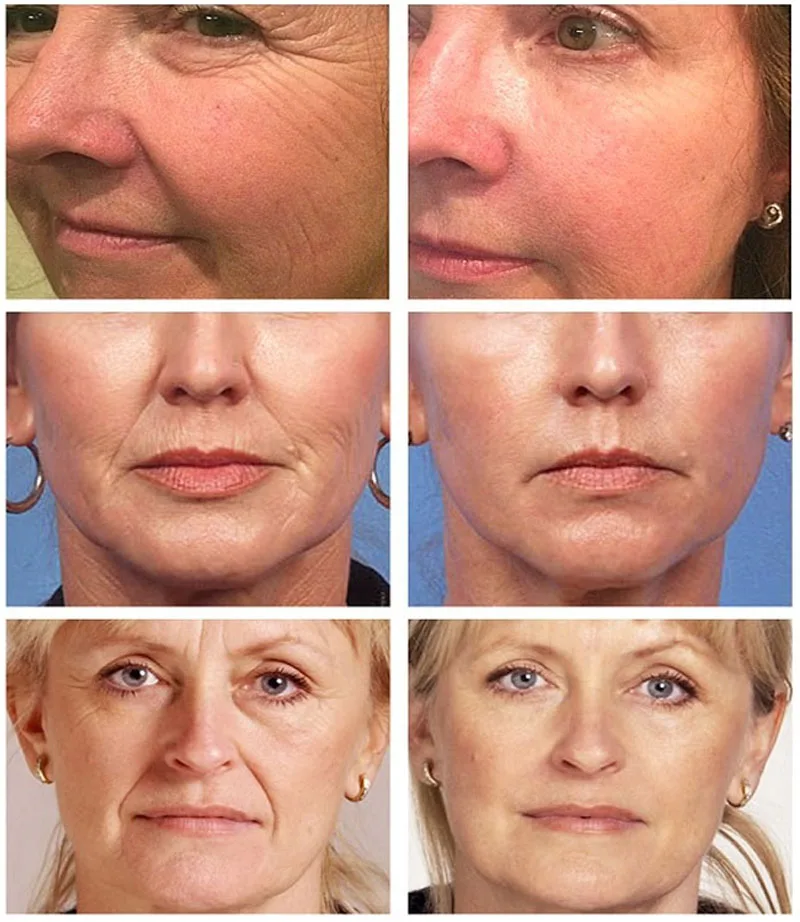 Sérum dissolvant de collagène  - Vitamin C Serum Face avis et prix